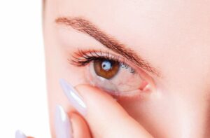 A close up of a woman putting in a contact lens with dry eyes.