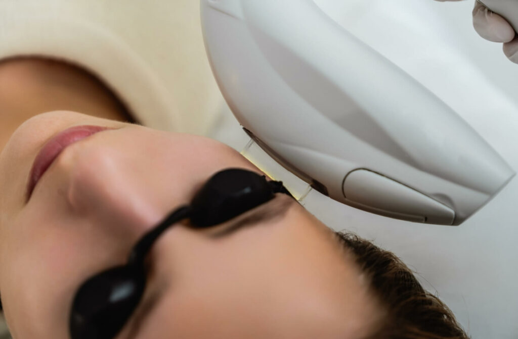 A close-up photo of a patient receiving IPL Therapy.