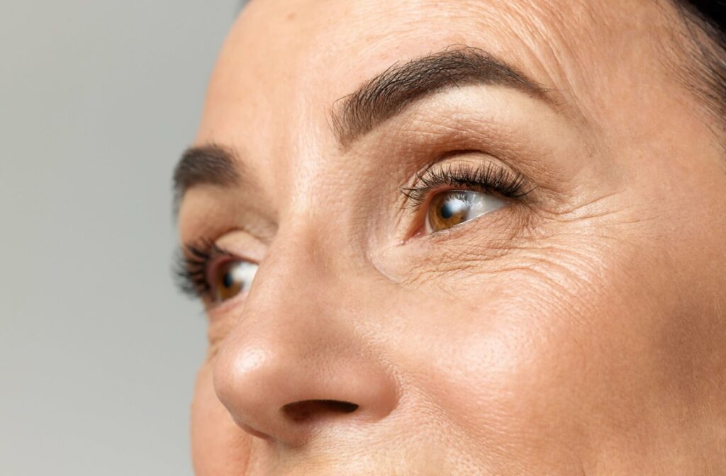 Close-up of a woman’s eyes showing fine lines and wrinkles around the eye area.