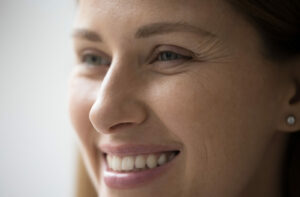 Close-up of a smiling woman showing fine lines and wrinkles around her eyes.